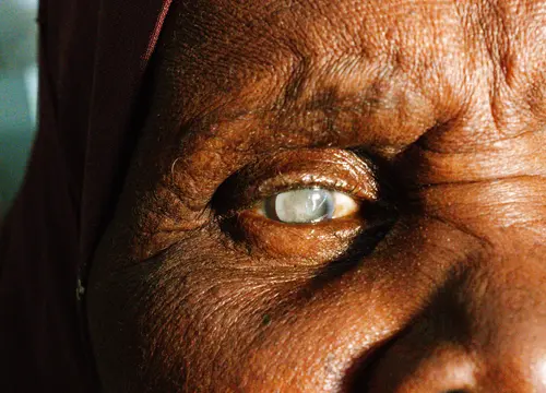 Extreme close-up of an older Black man’s eye, with sunlight revealing the texture of his skin and a clouded iris.